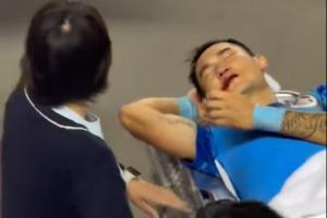 聚盈策略 新鹏城官方：廖力生鼻骨粉碎性骨折，已完成鼻骨骨折复位术出院